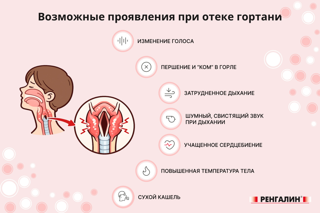 Симптомы отека гортани Ренгалин: Симптомы отека гортани